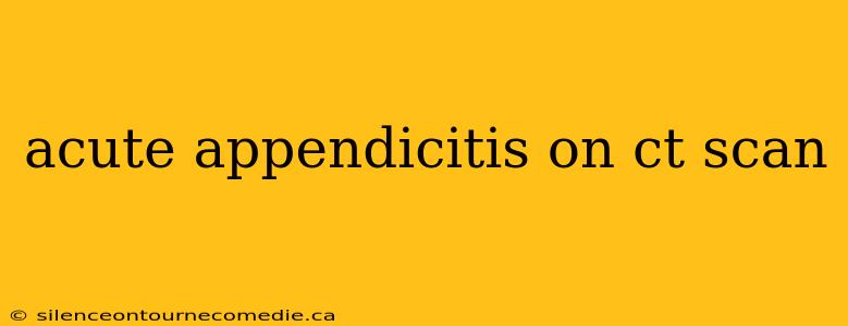 acute appendicitis on ct scan