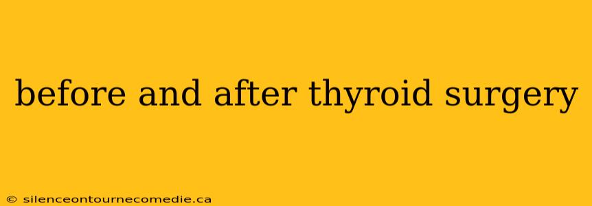 before and after thyroid surgery