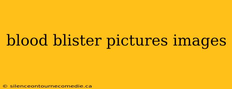 blood blister pictures images