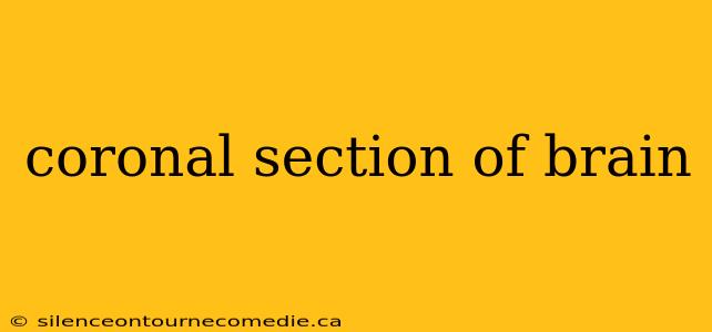 coronal section of brain