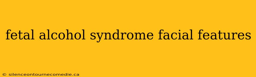 fetal alcohol syndrome facial features
