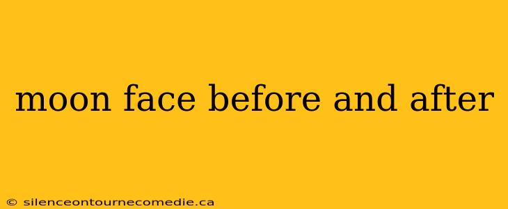 moon face before and after