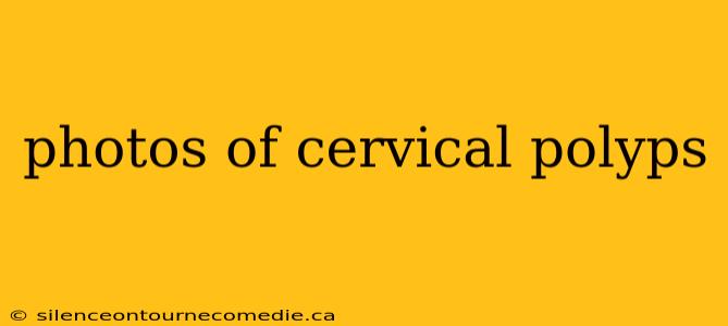 photos of cervical polyps