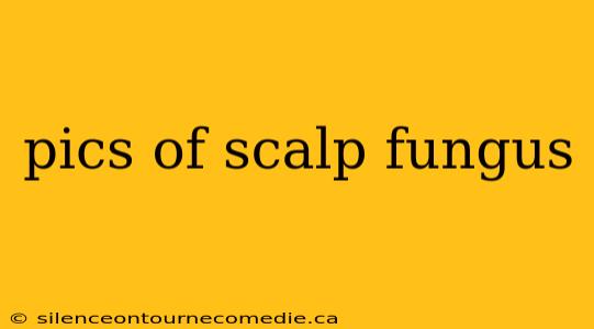 pics of scalp fungus