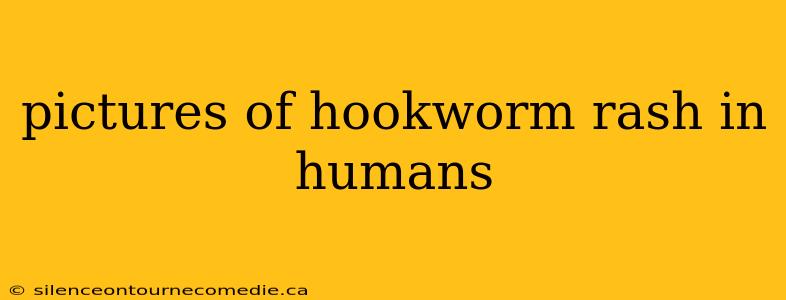 pictures of hookworm rash in humans