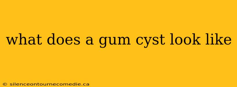 what does a gum cyst look like