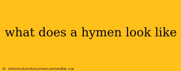 what does a hymen look like