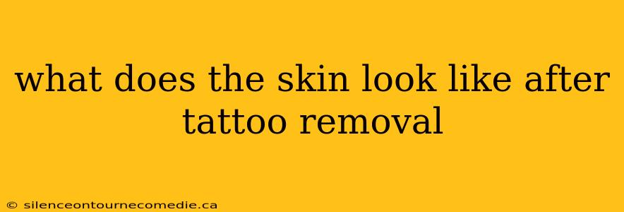 what does the skin look like after tattoo removal